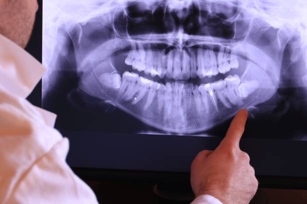 Best Emergency Dental Services for Seniors in Royal Palm Beach, FL